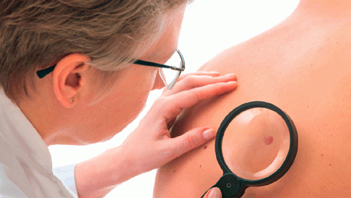 Consulta dermatología por 49€