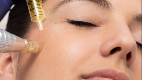 Facial Renovador con Colágeno Dorado y Micro needling 